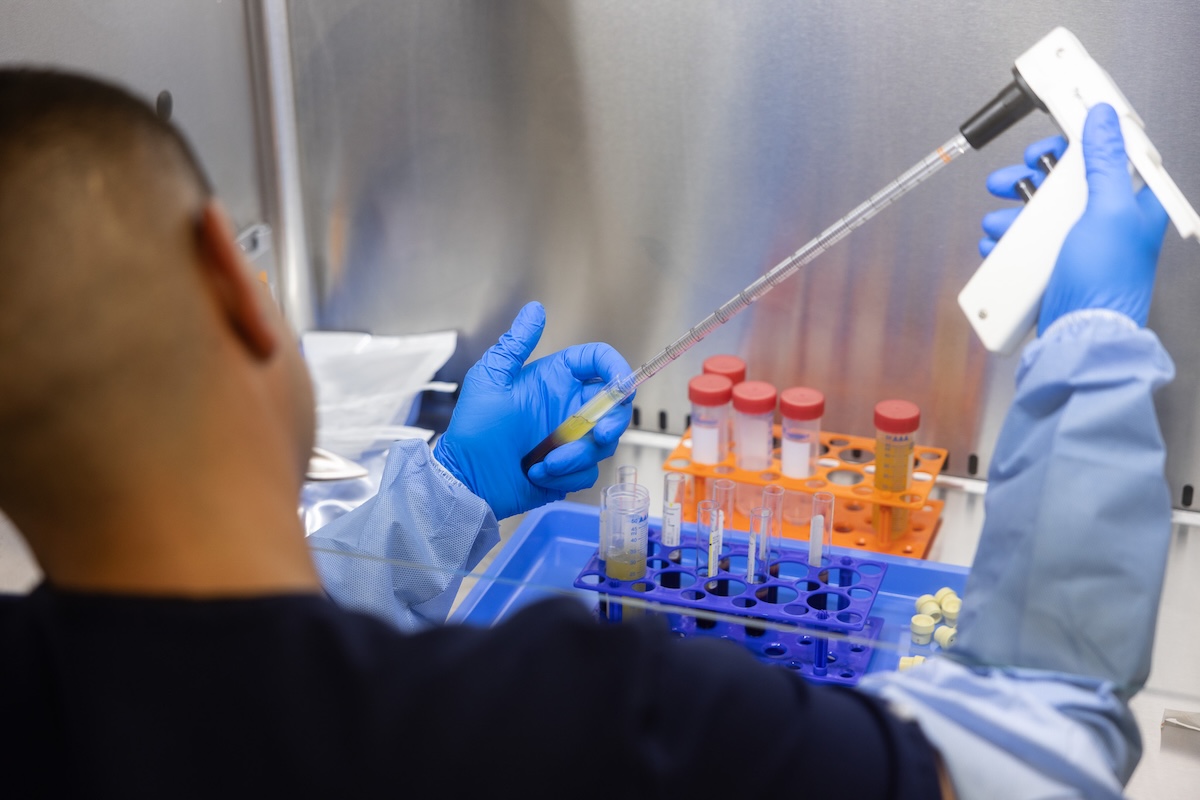 platelet rich plasma prp therapy miami