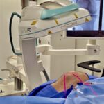 intraosseous stem cell injection knee Miami — Dr. William Bonner Miami